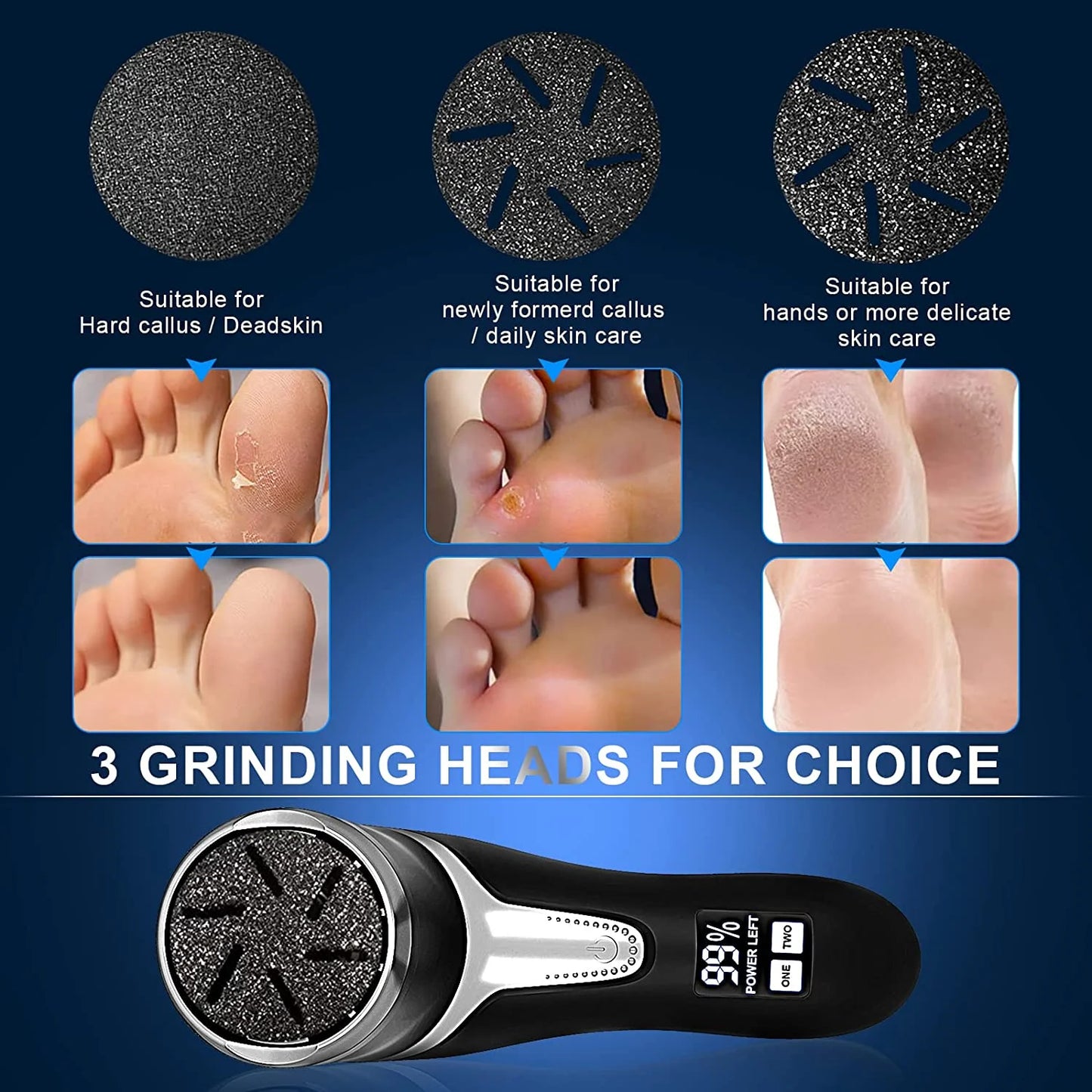 The SoleSmooth Pro - Electric Callus Remover & Pedicure System with 3 Attachments