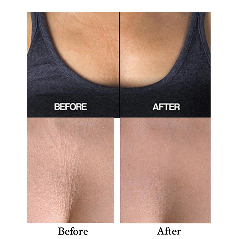 The Décolleté Smooth Pad - Reusable Silicone Patches for Neck & Chest Wrinkles