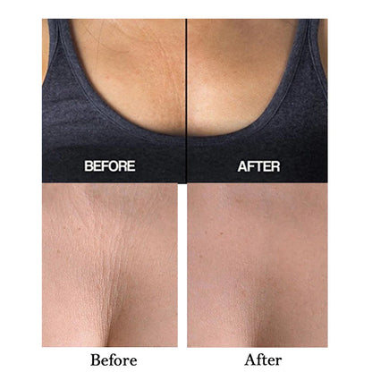 The Décolleté Smooth Pad - Reusable Silicone Patches for Neck & Chest Wrinkles